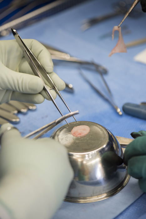Cartilage graft