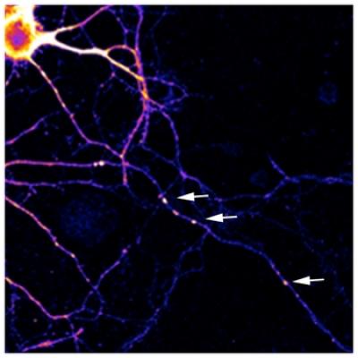 Neurons