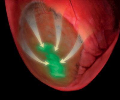 Implanting Embryonic Cardiac Cells Prevents Arrhythmias