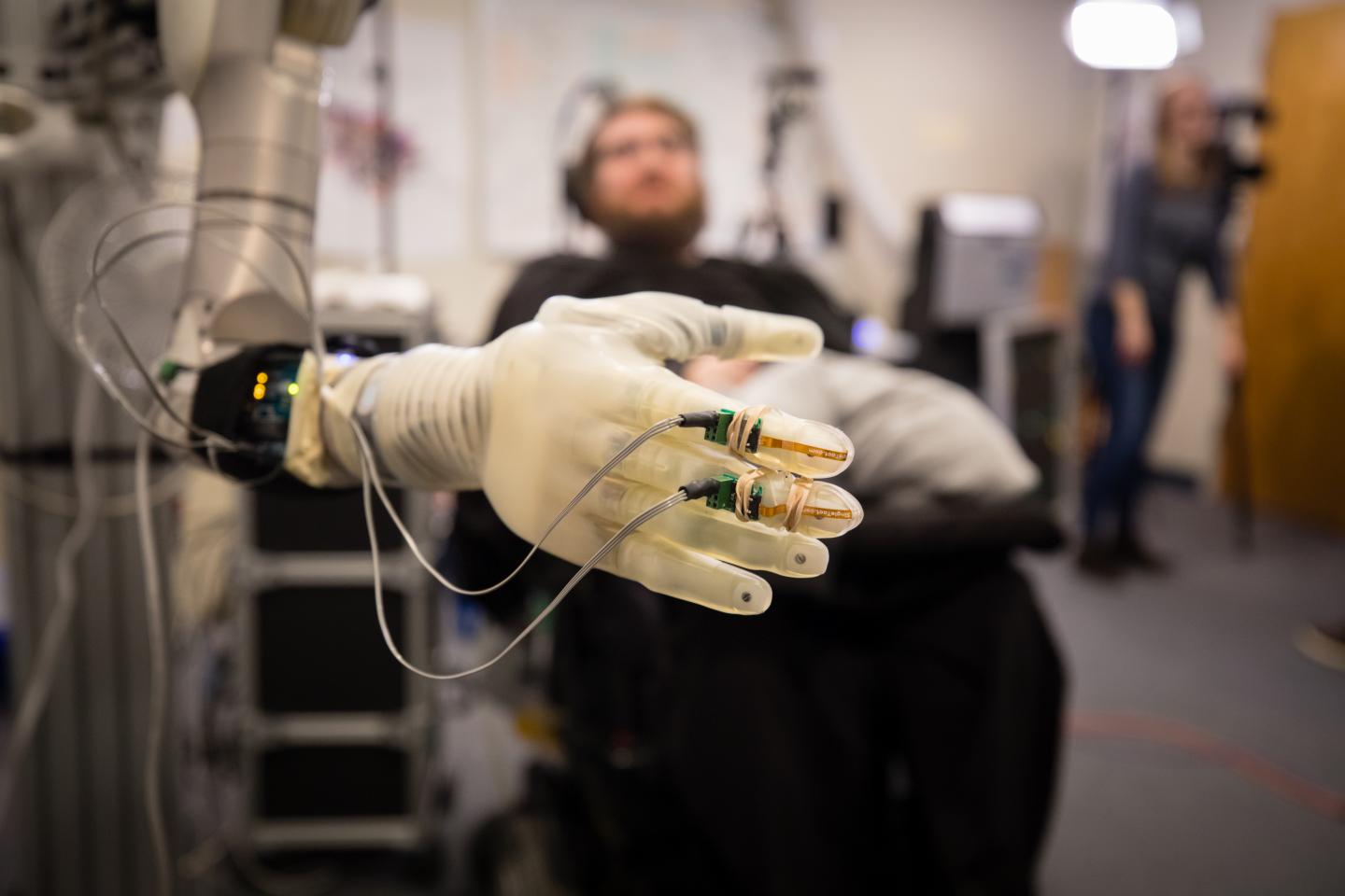 Patient with Prosthetic Hand