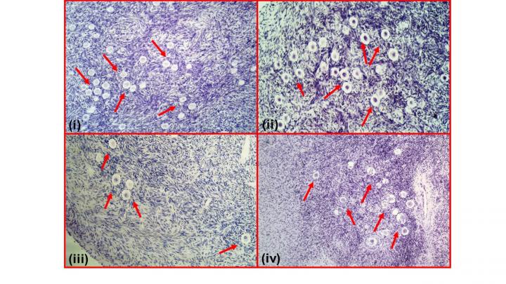 Ovarian Tissue