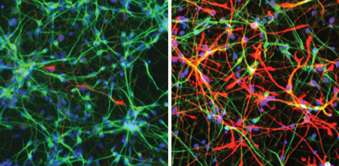 Power Up: Growing Neurons Undergo Major Metabolic Shift