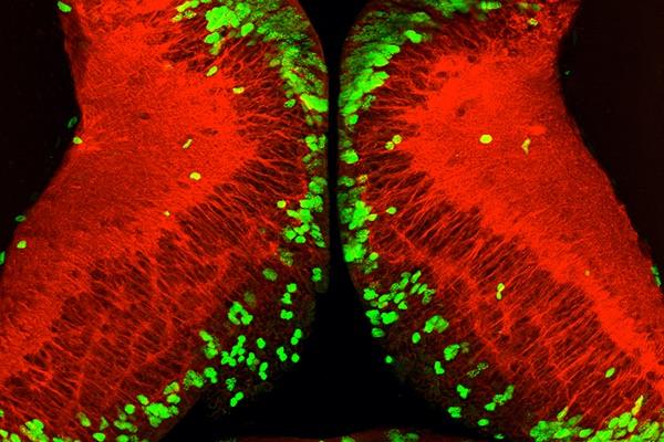 Hungry Cells Jump-Start Growth when Food Becomes Available