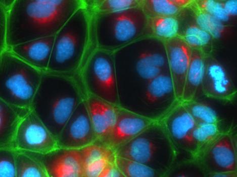 Upcyte Hepatocytes