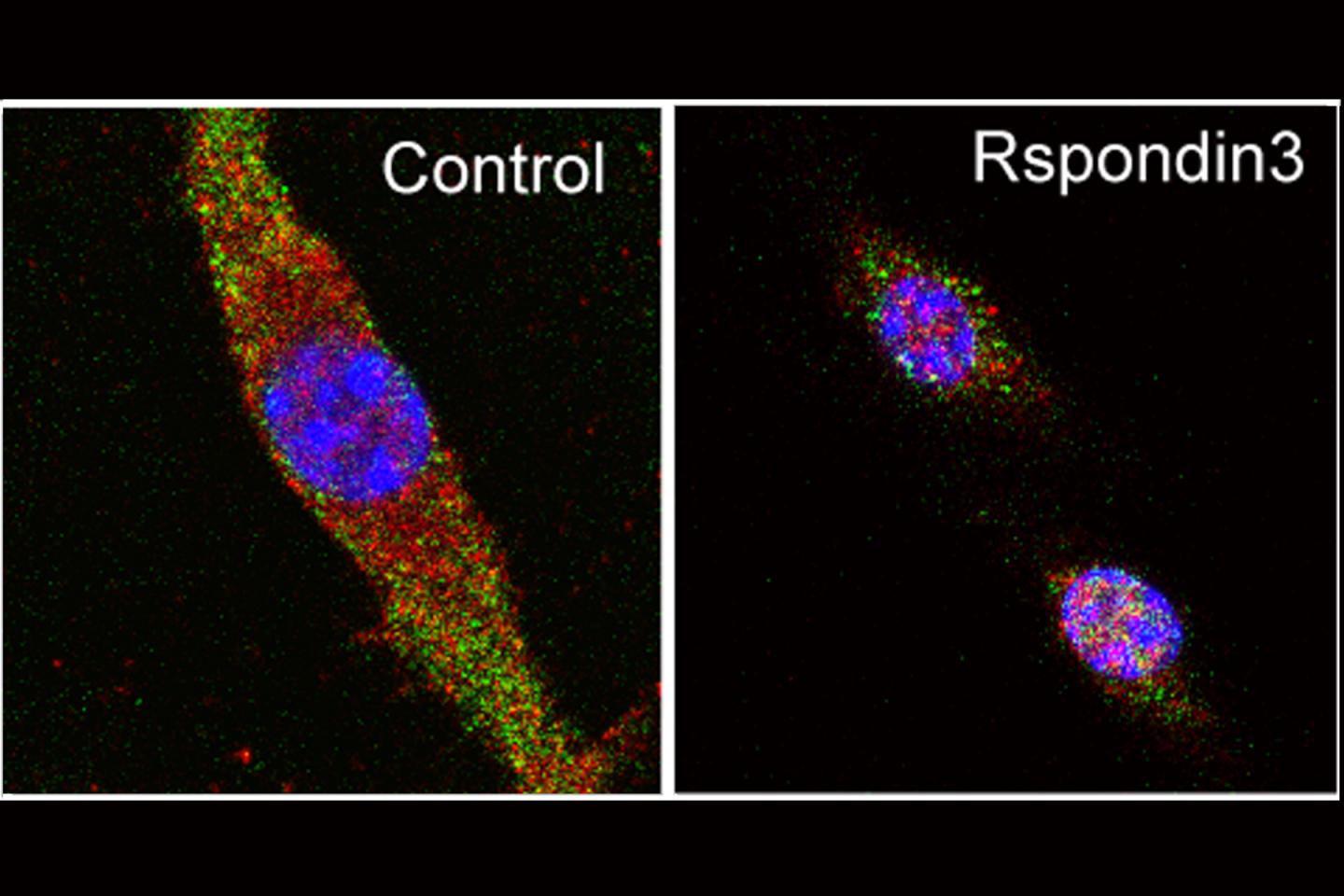 Fluorescent image of a macrophage