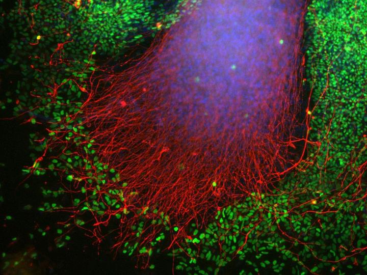 Stem Cells to Brain Cell