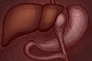 Bariatric Surgery Illustration