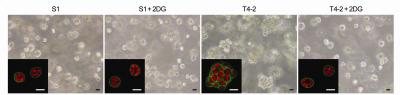 Glucose Uptake in Breast Cells