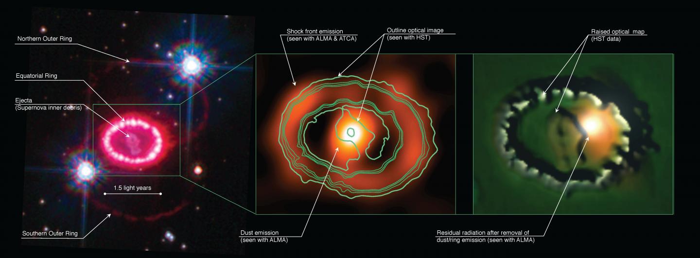 Supernova Remnant 1987A