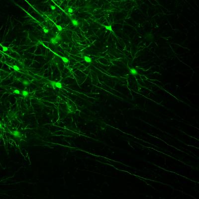 Overexcited Neurons