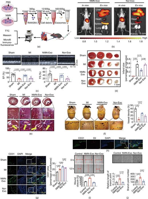 NMN-Exo improve the cardiac function of MI mice through angiogenesis.