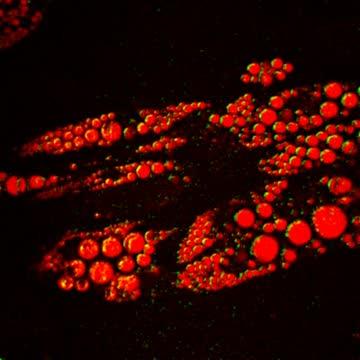 Steroid Switch May Lead to Fewer Side Effects in Adrenal Disorder (1 of 1)