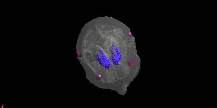 Non-invasive stimulation of the striatum