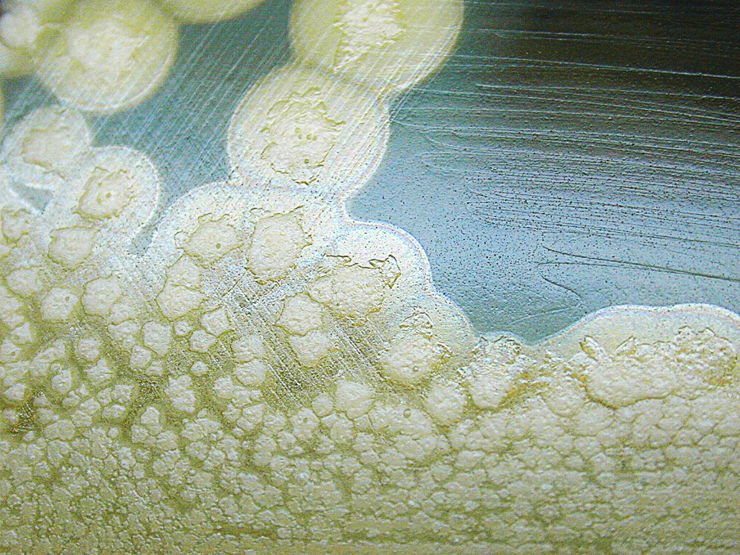 <i>Clostridium botulinum</i> Bacterium Colonies