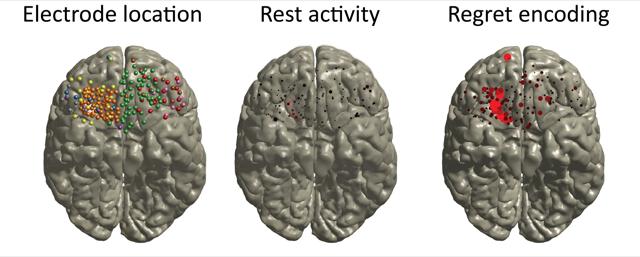 Gambler's Regret Recorded By Electrodes on the Surface of the Brain