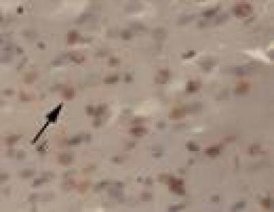 Cell Apoptosis
