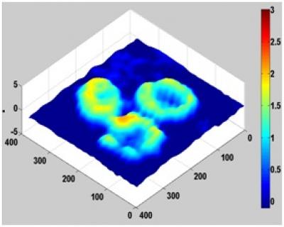 RBC Image