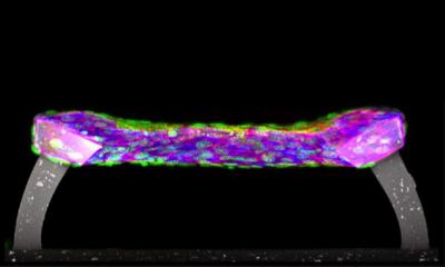 Measuring Tissue Failure