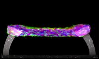 Measuring Tissue Failure
