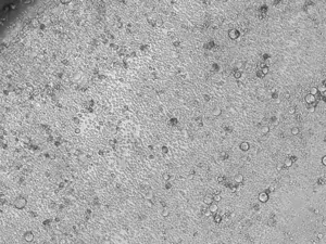 Image 2 – Mouse hematopoietic stem-cell culture (20x magnification)