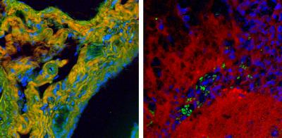 Enhanced NIST Instrument Enables High-speed Chemical Imaging of Tissues