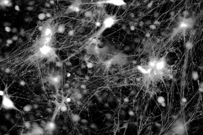 Neutrophil Enhancer Traps (NETs)