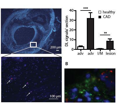 A Dynamic Duo of Small Molecules Shape Immune System Responses (1 of 2)