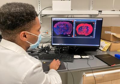 Brain Scans