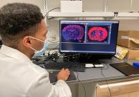 Brain Scans