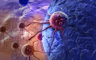Cancer Cells