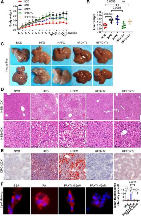 Administration of tirzepatide significantly attenuates hepatic lipid accumulation in MASLD mice.