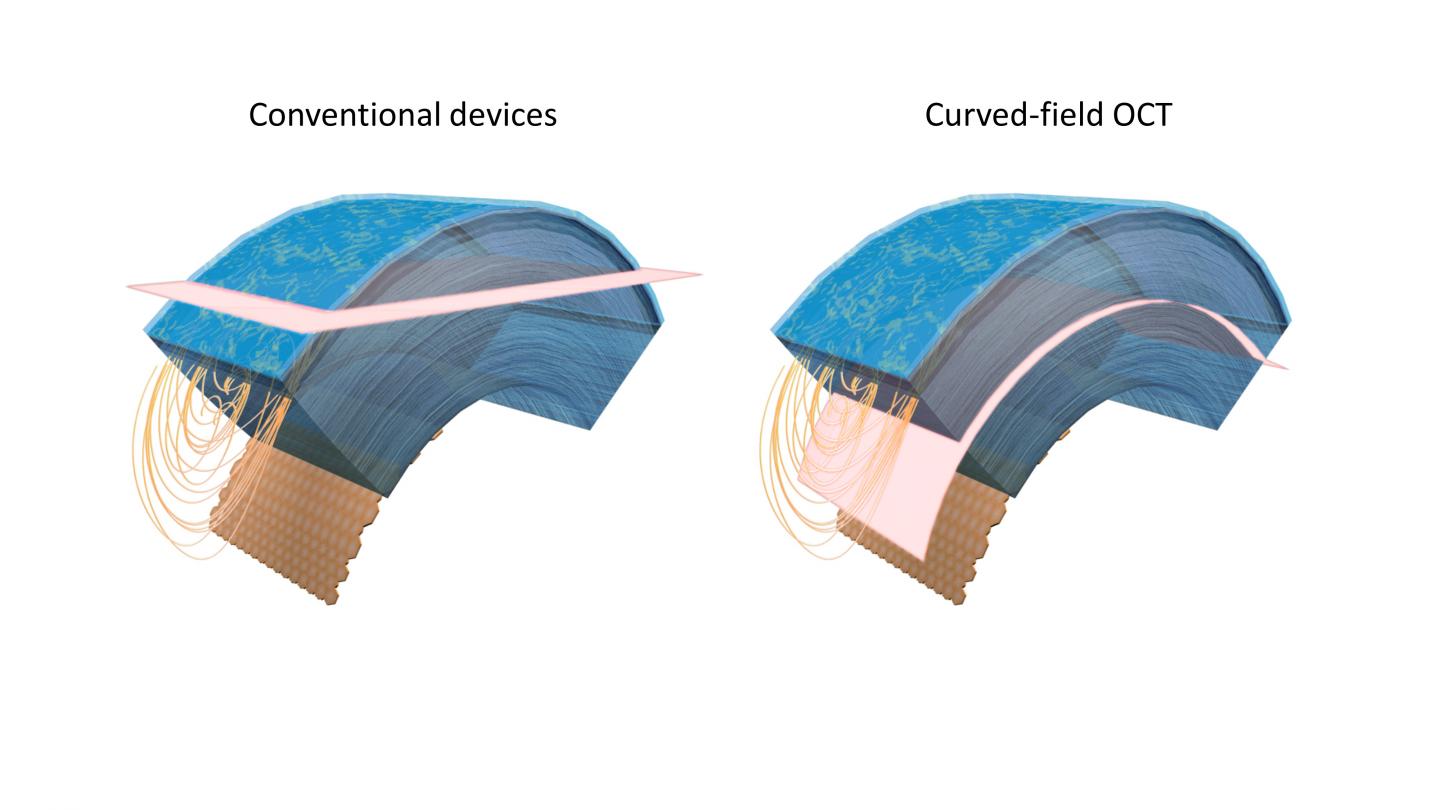 Conventional and curved-field OCT