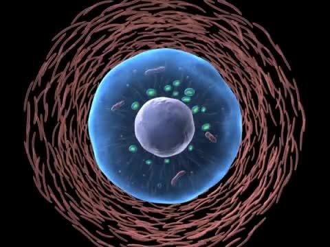 Excessive Lysosomal Exocytosis Promotes Tumor Invasion and Drug Resistance