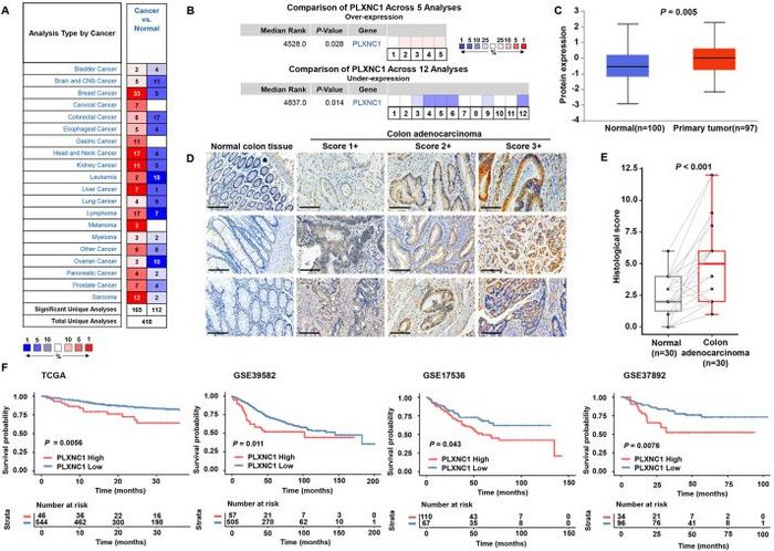 PLXNC1 is elevated and predicts worse outcomes in colorectal cancer