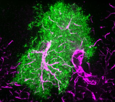 Astrocyte