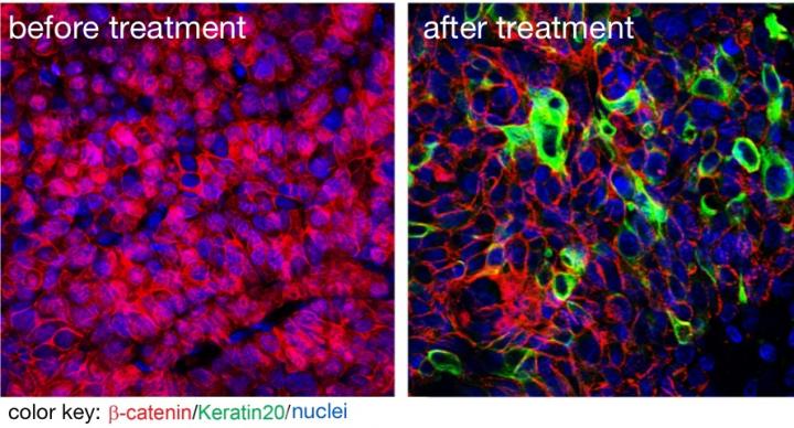 Cancer Stem Cells