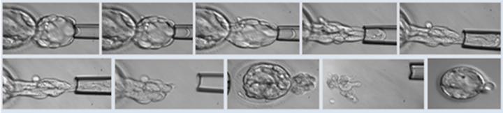Blastocyst Biopsy