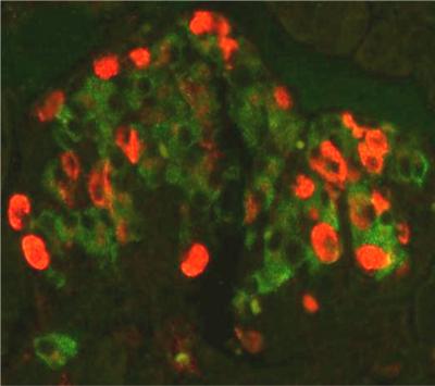 Insulin-Secreting Beta Cells 1
