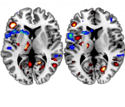 Brain Scan