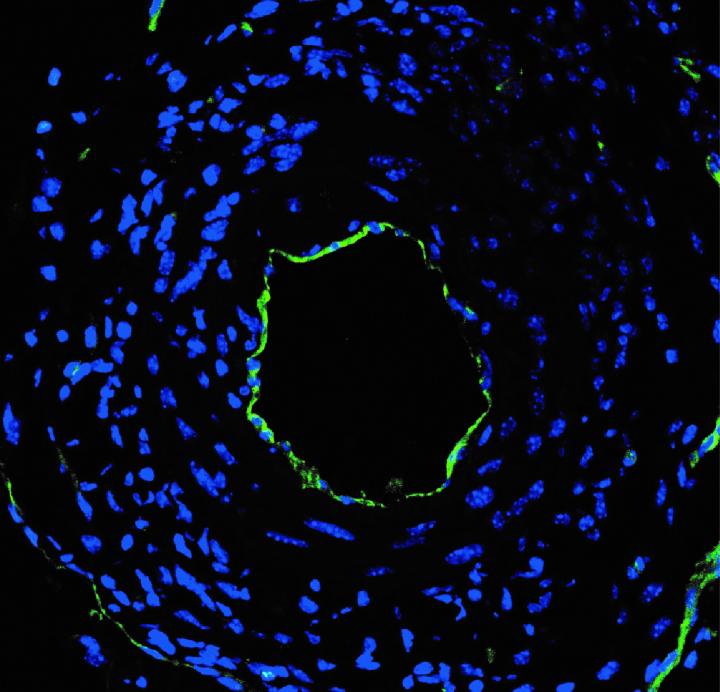 Artery targeted with microRNA-switch nanotherapy