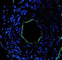 Artery targeted with microRNA-switch nanotherapy