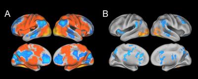 Brain Scans