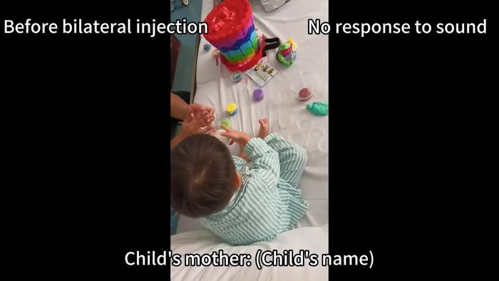 Young Trial Participant Tracked for 2 years, 7 months after OTOF gene therapy