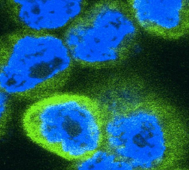 Cervical Cancer Cells Expressing a Wound Healing Signal (Green) in Response to Trail Stimulation