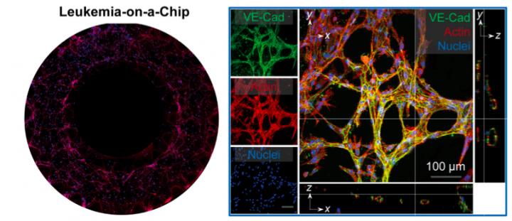 Image from Leukemia-On-A-Chip Cancer Microenvironment