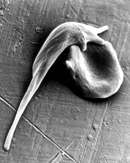 Sickled Blood Cell