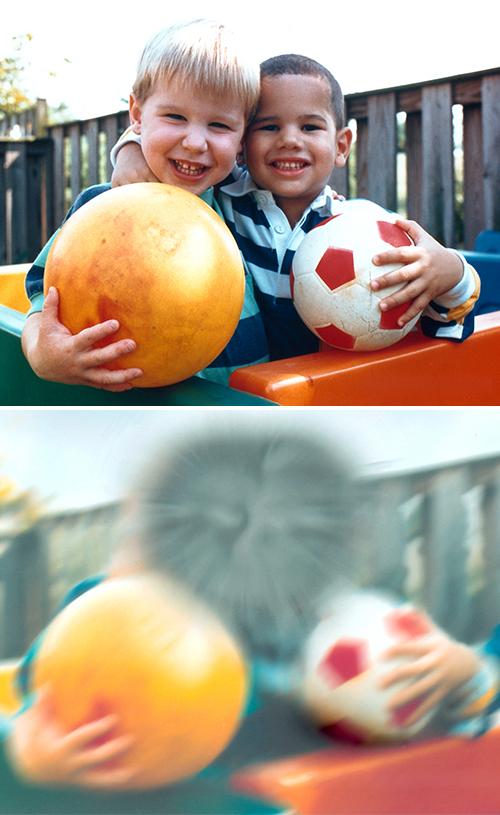 Age-Related Macular Degeneration