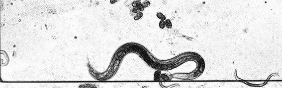 Nematode Worm Gets Caught in a Gel