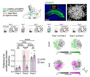 Why Do Dementia and Cognitive Decline Patients Remain Stuck in Past Memories?… KAIST Identifies Memory-Switching Mechanism​