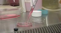 Resveratrol Melanoma Study